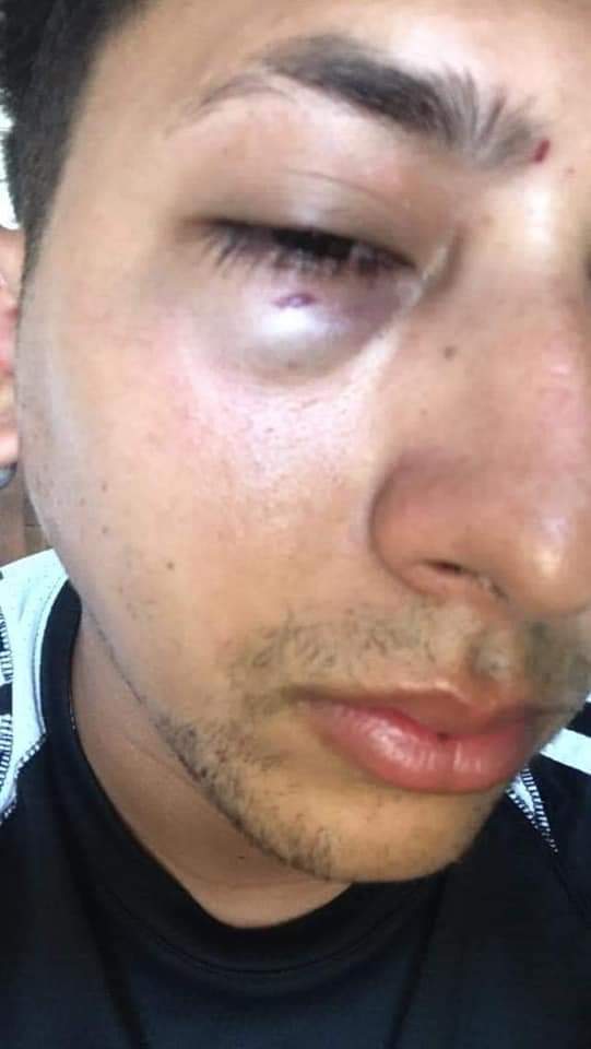 Asaltan a joven en la Fidel Velázquez