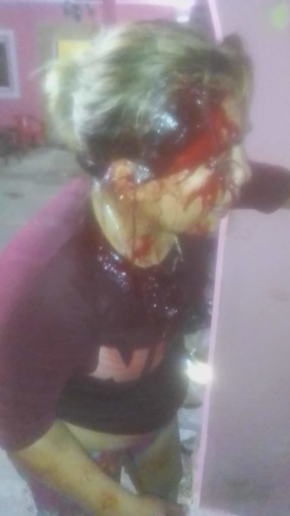 Policías de Halachó presuntamente agrede a famailia
