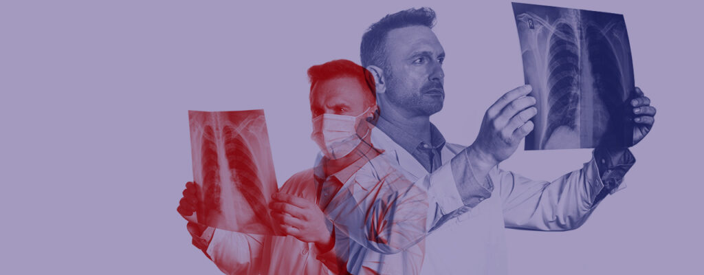 El cáncer de pulmón, uno de los tumores más letales