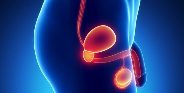 El cáncer de próstata se puede prevenir y evitar la muerte