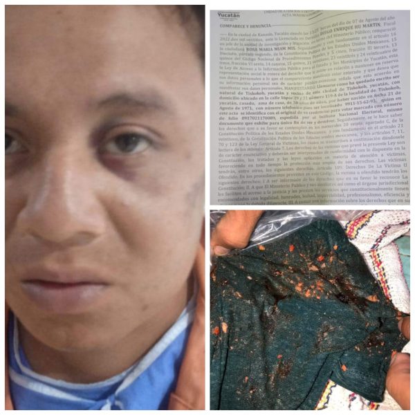 Denuncian a policías de Tixkokob por golpear a un joven detenido