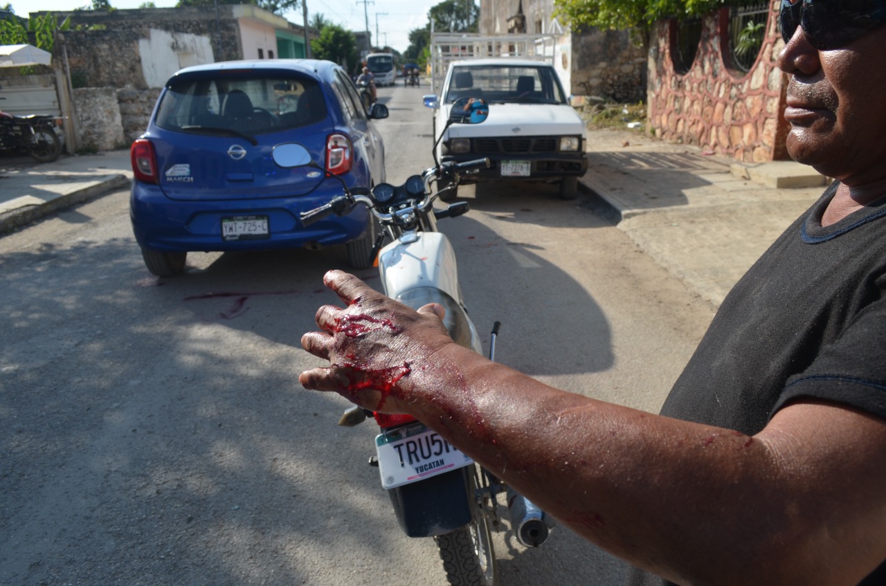 Imprudencia y alcohol provocan choque en Seyé
